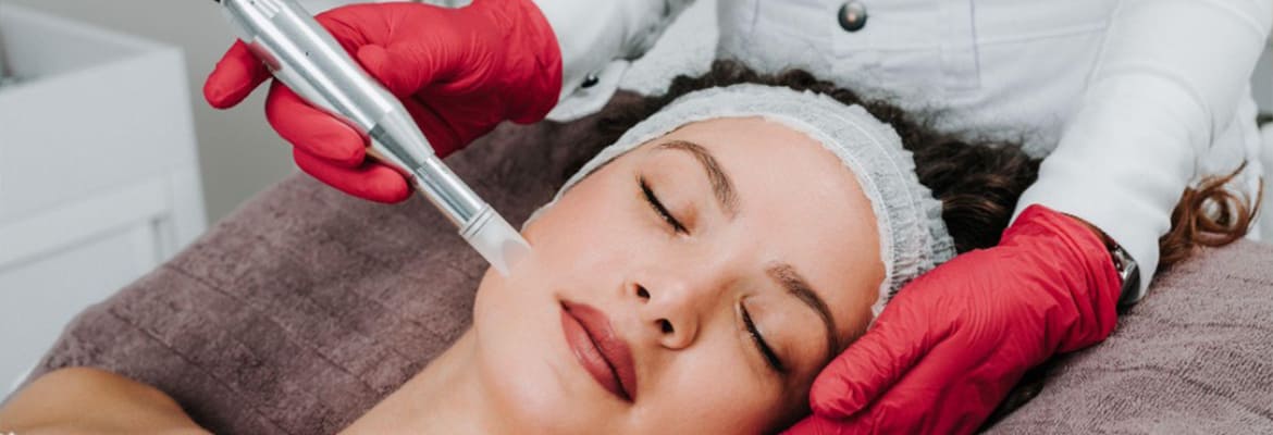How Soon Can You Microneedle After Getting Fillers? post