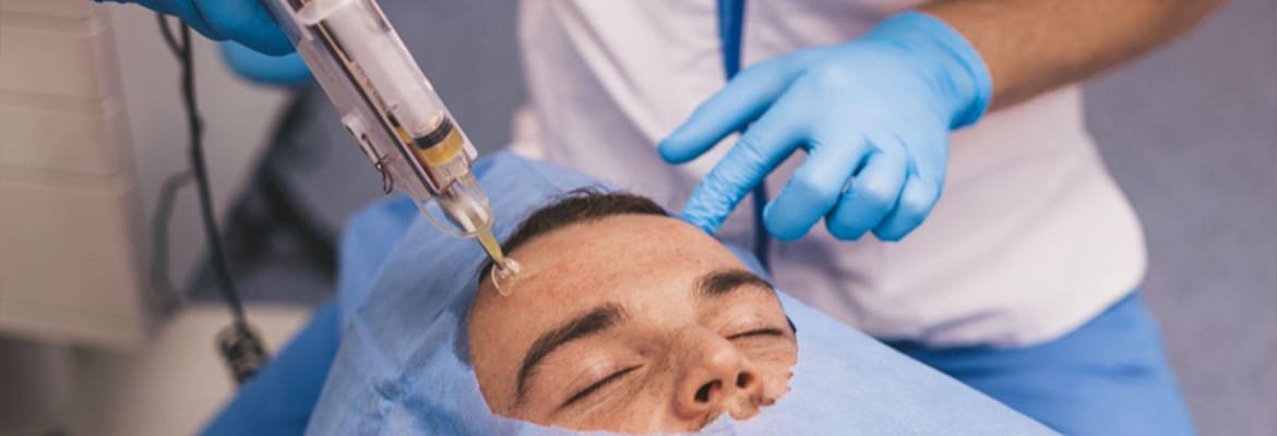 How PRP Can Treat Scars, Wrinkles, and Hair Loss